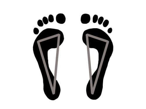cavovarus foot